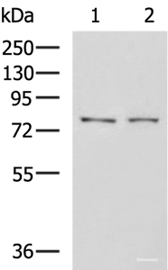 Western blot analysis of K562 cell Mouse liver tissue lysates using GPCPD1 Polyclonal Antibody at dilution of 1:650