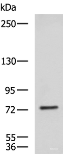 Western blot analysis of NIH/3T3 cell lysate using KIF2A Polyclonal Antibody at dilution of 1:850