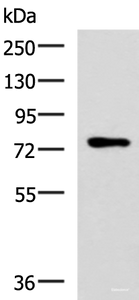 Western blot analysis of Mouse thymus tissue lysate using L3MBTL2 Polyclonal Antibody at dilution of 1:800