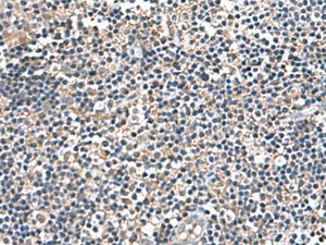 Immunohistochemistry of paraffin-embedded Human tonsil tissue using IP6K2 Polyclonal Antibody at dilution of 1:140 (×200)