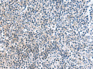 Immunohistochemistry of paraffin-embedded Human tonsil tissue using FAM107B Polyclonal Antibody at dilution of 1:160 (×200)