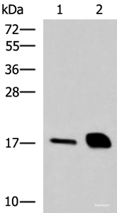 Western blot analysis of Mouse pancreas tissue and Rat pancreas tissue lysates using RNASE1 Polyclonal Antibody at dilution of 1:550