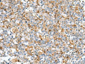 Immunohistochemistry of paraffin-embedded Human tonsil tissue using DNPH1 Polyclonal Antibody at dilution of 1:55 (×200)