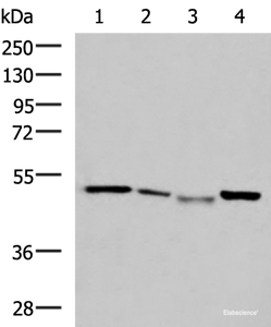 Western blot analysis of HepG2 cell Hela cell Mouse kidney tissue K562 cell lysates using NFS1 Polyclonal Antibody at dilution of 1:800