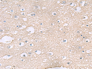 Immunohistochemistry of paraffin-embedded Human brain tissue using TAGLN3 Polyclonal Antibody at dilution of 1:60 (×200)
