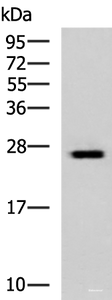 Western blot analysis of Hela cell lysate using GINS3 Polyclonal Antibody at dilution of 1:800