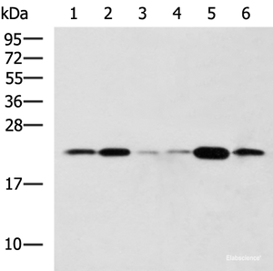 Western blot analysis of Raji Hela cell Mouse liver tissue Rat lung tissue Mouse Pancreas tissue NIH/3T3 cell lysates using TMED10 Polyclonal Antibody at dilution of 1:800