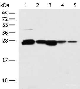 Western blot analysis of 293T HepG2 cell Human fetal liver tissue Human liver tissue TM4 cell lysates using CCDC134 Polyclonal Antibody at dilution of 1:800