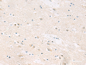 Immunohistochemistry of paraffin-embedded Human brain tissue using ANKS6 Polyclonal Antibody at dilution of 1:55 (×200)