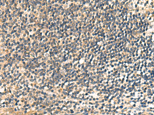 Immunohistochemistry of paraffin-embedded Human tonsil tissue using CNST Polyclonal Antibody at dilution of 1:60 (×200)