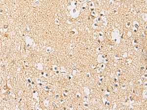 Immunohistochemistry of paraffin-embedded Human brain tissue using IDS Polyclonal Antibody at dilution of 1:70 (×200)