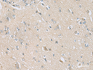 Immunohistochemistry of paraffin-embedded Human brain tissue using TSTA3 Polyclonal Antibody at dilution of 1:80 (×200)