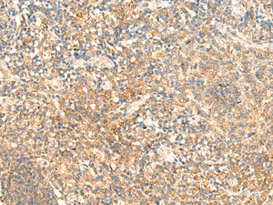 Immunohistochemistry of paraffin-embedded Human tonsil tissue using CD93 Polyclonal Antibody at dilution of 1:50 (×200)