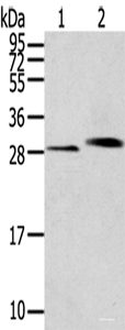 Western blot analysis of Human normal kidney tissue Human liver tissue using CLIC4 Polyclonal Antibody at dilution of 1:200