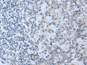 Immunohistochemistry of paraffin-embedded Human tonsil tissue using STARD4 Polyclonal Antibody at dilution of 1:50 (×200)