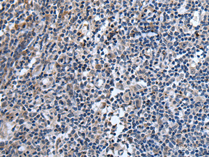Immunohistochemistry of paraffin-embedded Human tonsil tissue using TNFSF18 Polyclonal Antibody at dilution of 1:45 (×200)
