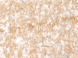Immunohistochemistry of paraffin-embedded Human brain tissue using XPC Polyclonal Antibody at dilution of 1:25 (×200)