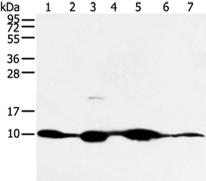 Western blot analysis of Mouse muscle and human fetal muscle tissue mouse heart tissue and PC3 cell mouse kidney and small intestines tissue 231 cell using COX7C Polyclonal Antibody at dilution of 1:300