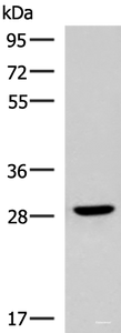 Western blot analysis of Human fetal brain tissue lysate using CLEC9A Polyclonal Antibody at dilution of 1:800