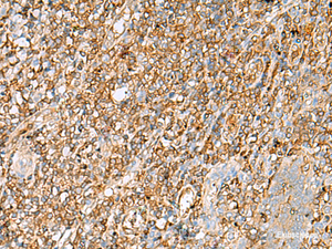 Immunohistochemistry of paraffin-embedded Human tonsil tissue using LGALS9 Polyclonal Antibody at dilution of 1:30 (×200)