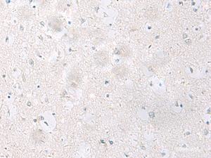 Immunohistochemistry of paraffin-embedded Human brain tissue using SST Polyclonal Antibody at dilution of 1:60 (×200)