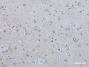 Immunohistochemistry of paraffin-embedded Human brain tissue using CENPF Polyclonal Antibody at dilution of 1:60 (×200)