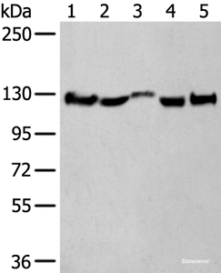 Western blot analysis of Rat brain tissue Mouse brain tissue Human fetal brain tissue Human cerebrum tissue Human cerebella tissue lysates using CNTN1 Polyclonal Antibody at dilution of 1:550