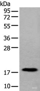 Western blot analysis of Human urinary bladder tissue lysate using MYL12B Polyclonal Antibody at dilution of 1:250