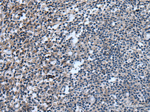 Immunohistochemistry of paraffin-embedded Human tonsil tissue using UGT8 Polyclonal Antibody at dilution of 1:55 (×200)