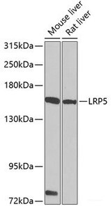 Western blot analysis of extracts of various cell lines using LRP5 Polyclonal Antibody at dilution of 1:1000.