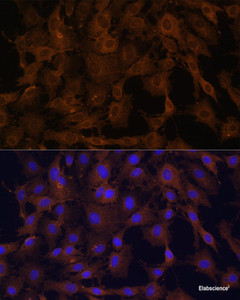 Immunofluorescence analysis of C6 cells using BID Polyclonal Antibody at dilution of 1:100. Blue: DAPI for nuclear staining.