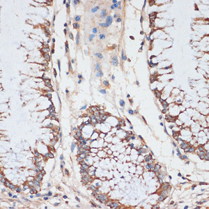 Immunohistochemistry of paraffin-embedded Human colon using CDK4 Polyclonal Antibody at dilution of 1:100 (40x lens) .