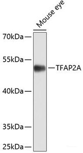 Western blot analysis of extracts of Mouse eye using TFAP2A Polyclonal Antibody at dilution of 1:1000.