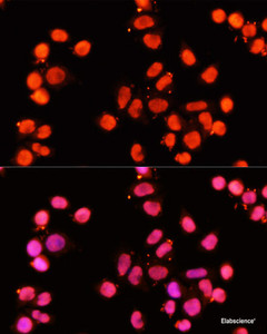 Immunofluorescence analysis of HeLa cells using XRCC1 Polyclonal Antibody at dilution of 1:100 (40x lens) . Blue: DAPI for nuclear staining.