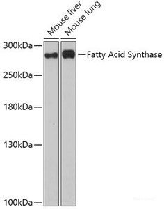 Western blot analysis of extracts of various cell lines using Fatty Acid Synthase Polyclonal Antibody at dilution of 1:1000.