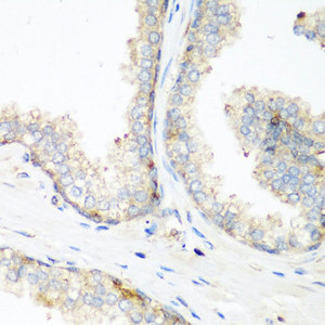 Immunohistochemistry of paraffin-embedded Human prostate using NEDD4 Polyclonal Antibody at dilution of 1:200 (40x lens) .