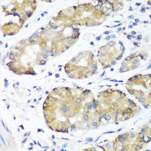 Immunohistochemistry of paraffin-embedded Human stomach using NOTCH2 Polyclonal Antibody at dilution of 1:100 (40x lens) .