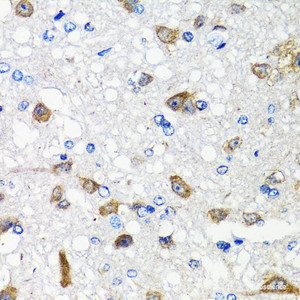 Immunohistochemistry of paraffin-embedded Rat brain using ACVR1C Polyclonal Antibody at dilution of 1:100 (40x lens) .