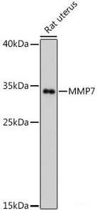 Western blot analysis of extracts of Rat uterus using MMP7 Polyclonal Antibody at dilution of 1:500.