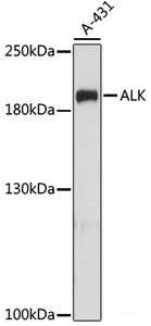 Western blot analysis of extracts of A-431 cells using ALK Polyclonal Antibody at dilution of 1:1000.