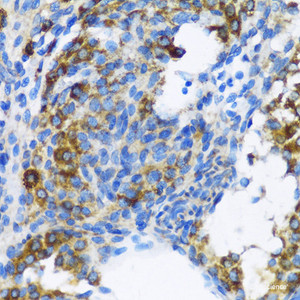 Immunohistochemistry of paraffin-embedded Rat ovary using PTCH1 Polyclonal Antibody at dilution of 1:100 (40x lens) .