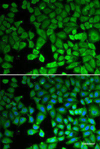 Immunofluorescence analysis of U2OS cells using NUR77 Polyclonal Antibody