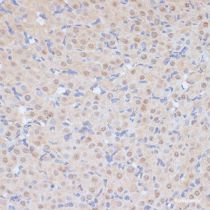 Immunohistochemistry of paraffin-embedded Rat ovary using CDK9 Polyclonal Antibody at dilution of 1:100 (40x lens) .
