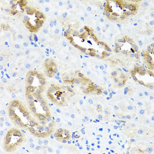 Immunohistochemistry of paraffin-embedded Rat kidney using FABP5 Polyclonal Antibody at dilution of 1:100 (40x lens) .