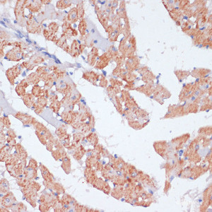 Immunohistochemistry of paraffin-embedded Rat heart using ARRB1 Polyclonal Antibody at dilution of 1:100 (40x lens) .