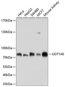 Western blot analysis of extracts of various cell lines using UGT1A6 Polyclonal Antibody at dilution of 1:1000.