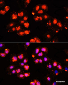 Immunofluorescence analysis of HeLa cells using HOXB9 Polyclonal Antibody at dilution of 1:100 (40x lens) . Blue: DAPI for nuclear staining.