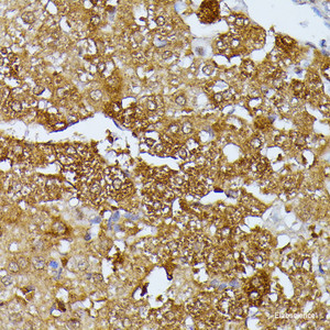 Immunohistochemistry of paraffin-embedded Rat liver using SEPT4 Polyclonal Antibody at dilution of 1:100 (40x lens) .