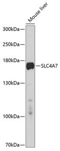 Western blot analysis of extracts of Mouse liver using SLC4A7 Polyclonal Antibody at dilution of 1:1000.