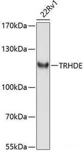 Western blot analysis of extracts of 22Rv1 cells using TRHDE Polyclonal Antibody at dilution of 1:1000.